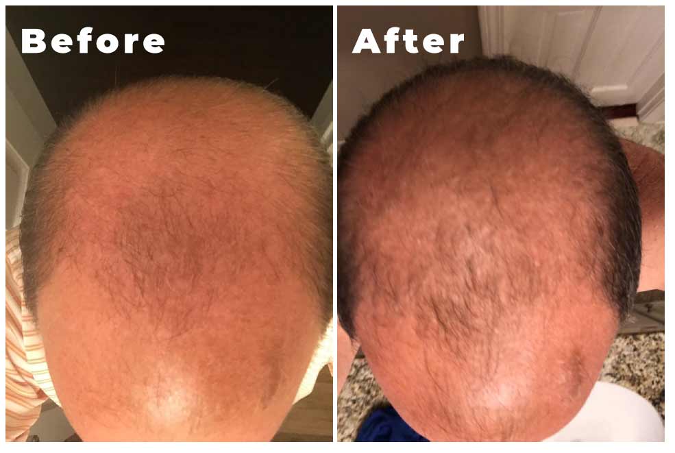 Anagen Nutra Peptide Shampoo
